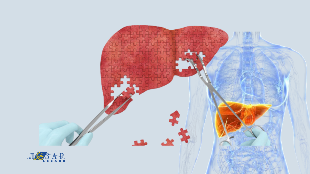 Пересадка печени в Турции: почему это становится новым направлением медицинского туризма?